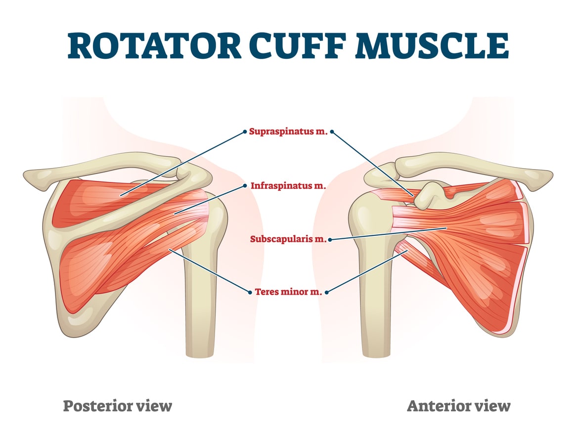 What Are Torn Rotator Cuff Symptoms? Doctors Explain How To Treat